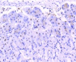 FUBP1 Rabbit anti-Human, Clone: SY11-04, Novus Biologicals 100&mu;L:Antibodies,