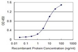 FUBP1 Antibody (1E10), Novus Biologicals 0.1 mg | Buy Online | Novus Biologicals | Fisher Scientific