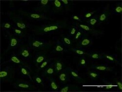 Novus Biologicals FUBP1 Antibody (2H3), Novus Biologicals 0.1 mg | Buy Online | Novus Biologicals&trade; | Fisher Scientific