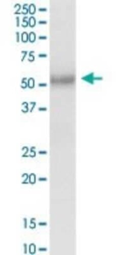 FUCA2 Antibody, Novus Biologicals 0.1 mg | Buy Online | Novus Biologicals | Fisher Scientific