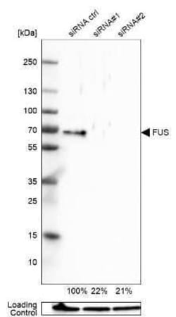 FUS Antibody, Novus Biologicals:Antibodies:Primary Antibodies