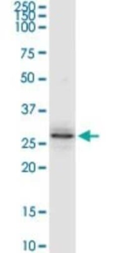 FUS2 Antibody, Novus Biologicals 0.1 mg | Buy Online | Novus Biologicals | Fisher Scientific
