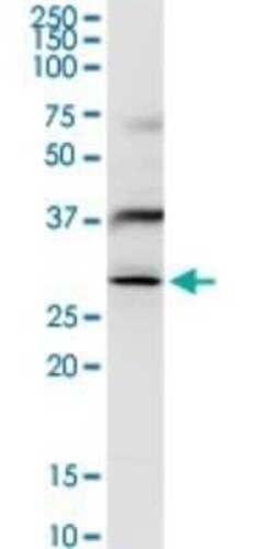 FUS2 Antibody, Novus Biologicals 0.1 mg | Buy Online | Novus Biologicals | Fisher Scientific