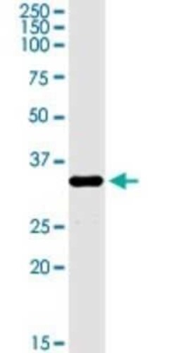 FUS2 Antibody, Novus Biologicals 0.1 mg | Buy Online | Novus Biologicals | Fisher Scientific