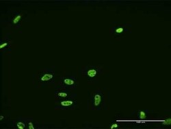 FUSIP1 Antibody (1G11), Novus Biologicals 0.1 mg | Buy Online | Novus Biologicals | Fisher Scientific