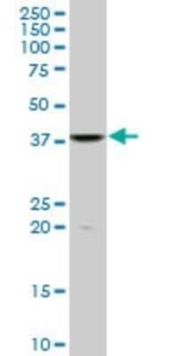FUSIP1 Antibody (1G11), Novus Biologicals 0.1 mg | Buy Online | Novus Biologicals | Fisher Scientific