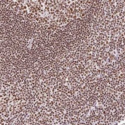 FUSIP1 Antibody, Novus Biologicals:Antibodies:Primary Antibodies
