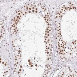 FUSIP1 Antibody, Novus Biologicals:Antibodies:Primary Antibodies