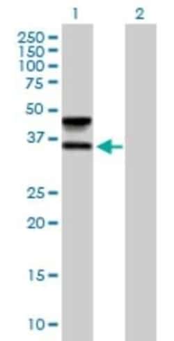FUT6 Antibody, Novus Biologicals 0.05 mg | Buy Online | Novus Biologicals | Fisher Scientific