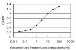 FXR/NR1H4 Antibody (1B10), Novus Biologicals 0.1 mg; Unconjugated:Antibodies,