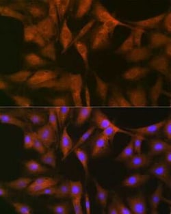 FXR1 Rabbit anti-Human, Mouse, Rat, Clone: 2S2B1, Novus Biologicals 100