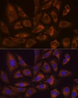 FXR1 Rabbit anti-Human, Mouse, Rat, Clone: 2S2B1, Novus Biologicals 100