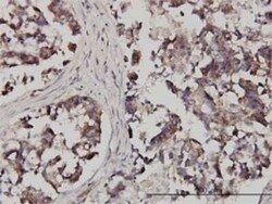 FXR1 Antibody (2G11), Novus Biologicals 0.1 mg | Buy Online | Novus Biologicals | Fisher Scientific