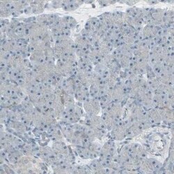FXYD3 Antibody, Novus Biologicals:Antibodies:Primary Antibodies