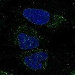 FXYD6-FXYD2 Antibody, Novus Biologicals:Antibodies:Primary Antibodies