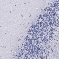 FYB/ADAP/SLAP130 Rabbit anti-Human, Polyclonal, Novus Biologicals:Antibodies:Primary