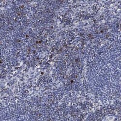 FYB/ADAP/SLAP130 Rabbit anti-Human, Polyclonal, Novus Biologicals:Antibodies:Primary
