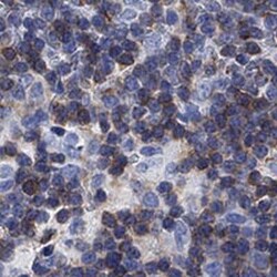 FYB/ADAP/SLAP130 Rabbit anti-Human, Polyclonal, Novus Biologicals:Antibodies:Primary