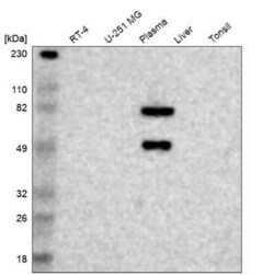 Factor XII Antibody, Novus Biologicals 0.1 mL | Buy Online | Novus Biologicals | Fisher Scientific