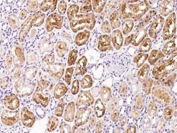 Factor XII heavy chain Antibody, Novus Biologicals 50 &mu;g; Unconjugated:Antibodies,