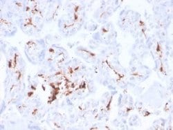 Factor XIIIa Antibody (F13A1/3772R) - Azide and BSA Free, Novus Biologicals