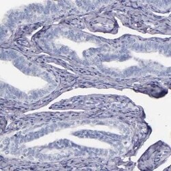 Factor XIIIa Antibody, Novus Biologicals 25 &mu;L | Buy Online | Novus Biologicals | Fisher Scientific