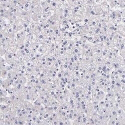 Factor XIIIa Antibody, Novus Biologicals 25 &mu;L | Buy Online | Novus Biologicals | Fisher Scientific