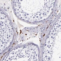 Factor XIIIa Antibody, Novus Biologicals 25 &mu;L | Buy Online | Novus Biologicals | Fisher Scientific