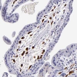 Factor XIIIa Antibody, Novus Biologicals 25 &mu;L | Buy Online | Novus Biologicals | Fisher Scientific