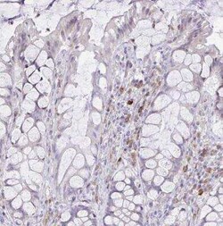 Fas Ligand/TNFSF6 Antibody, Novus Biologicals 25 &mu;L, Unconjugated:Antibodies,