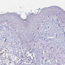 Fas Ligand/TNFSF6 Antibody, Novus Biologicals 25 &mu;L, Unconjugated:Antibodies,