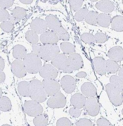 Fas Ligand/TNFSF6 Antibody, Novus Biologicals 25 &mu;L, Unconjugated:Antibodies,