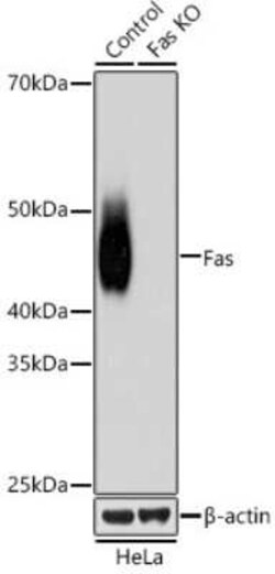 Fas/TNFRSF6/CD95 Rabbit anti-Human, Mouse, Rat, Clone: 5D10O3, Novus Biologicals 20 &mu;g | Buy Online | Novus Biologicals | Fisher Scientific