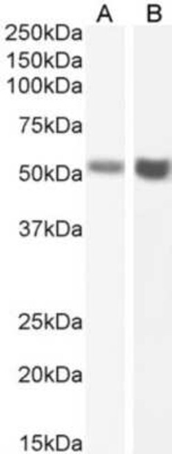 Fas/TNFRSF6/CD95, Rabbit anti-Human, Clone: R-125224, Novus Biologicals:Antibodies:Primary
