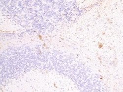 Fascin 2 Antibody, Novus Biologicals 0.1mg; Unlabeled:Antibodies, Polyclonal