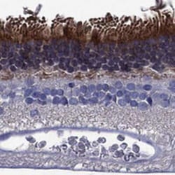 Fascin 2 Rabbit anti-Human, Polyclonal, Novus Biologicals 100 &mu;g | Buy Online | Novus Biologicals | Fisher Scientific