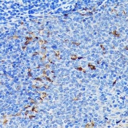 Fascin Rabbit anti-Human, Mouse, Rat, Clone: 1B3V6, Novus Biologicals 100