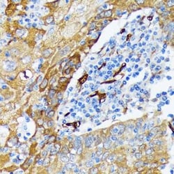 Fascin Rabbit anti-Human, Mouse, Rat, Clone: 1B3V6, Novus Biologicals 100