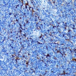 Fascin Rabbit anti-Human, Mouse, Rat, Clone: 1B3V6, Novus Biologicals 100