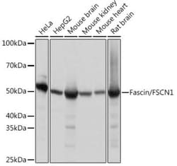 Fascin Rabbit anti-Human, Mouse, Rat, Clone: 1B3V6, Novus Biologicals 100