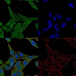Fascin Antibody (FSCN1/417), Novus Biologicals:Antibodies:Primary Antibodies