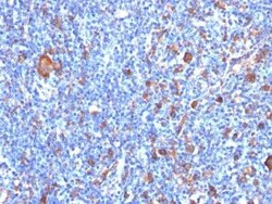 Fascin Antibody (FSCN1/417), Novus Biologicals:Antibodies:Primary Antibodies