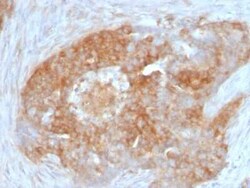 Fascin Antibody (FSCN1/417), Novus Biologicals:Antibodies:Primary Antibodies