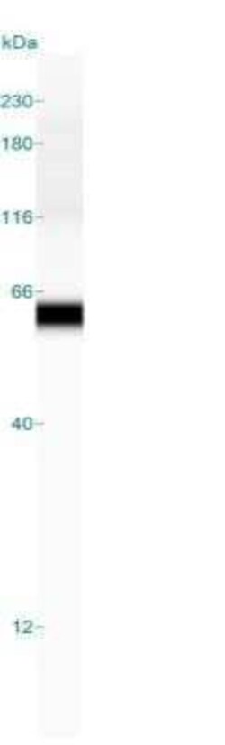Fascin Antibody (FSCN1/417), Novus Biologicals:Antibodies:Primary Antibodies