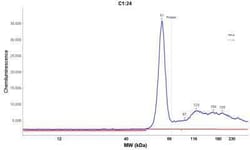 Fascin Antibody (FSCN1/417), Novus Biologicals:Antibodies:Primary Antibodies
