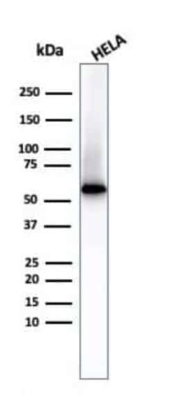 Fascin Antibody (FSCN1/417), Novus Biologicals:Antibodies:Primary Antibodies