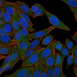 Fascin Antibody (FSCN1/418), Novus Biologicals 0.1mg; Unlabeled:Antibodies,