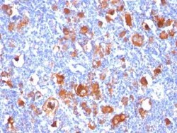 Fascin Antibody (FSCN1/418), Novus Biologicals 0.1mg; Unlabeled:Antibodies,