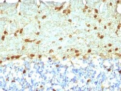 Fascin Antibody (FSCN1/418), Novus Biologicals 0.1mg; Unlabeled:Antibodies,