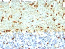 Fascin Antibody (FSCN1/418), Novus Biologicals 0.1mg; Unlabeled:Antibodies,